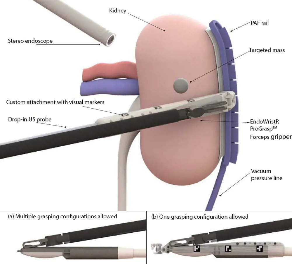 A digital depiction of how the EndoWristR Forceps gripper looks while grabbing the kidney (top). The configuration of the EndoWrist Forceps gripper where multiple grasping configurations are allowed (bottom left) and when only one grasping configuration is allowed (bottom right).
