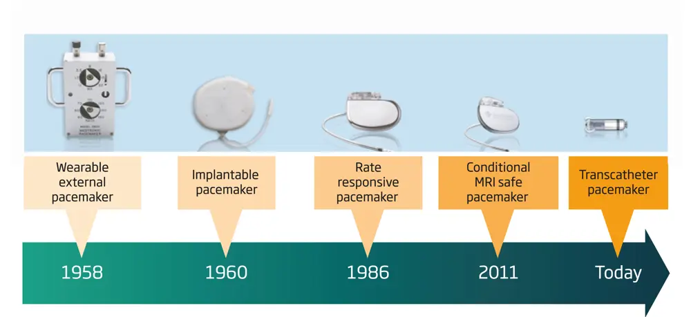 A schematic showing the evolution of cardiac pacemakers, from the wearable external pacemaker in 1958, to the transcatheter pacemaker used today.