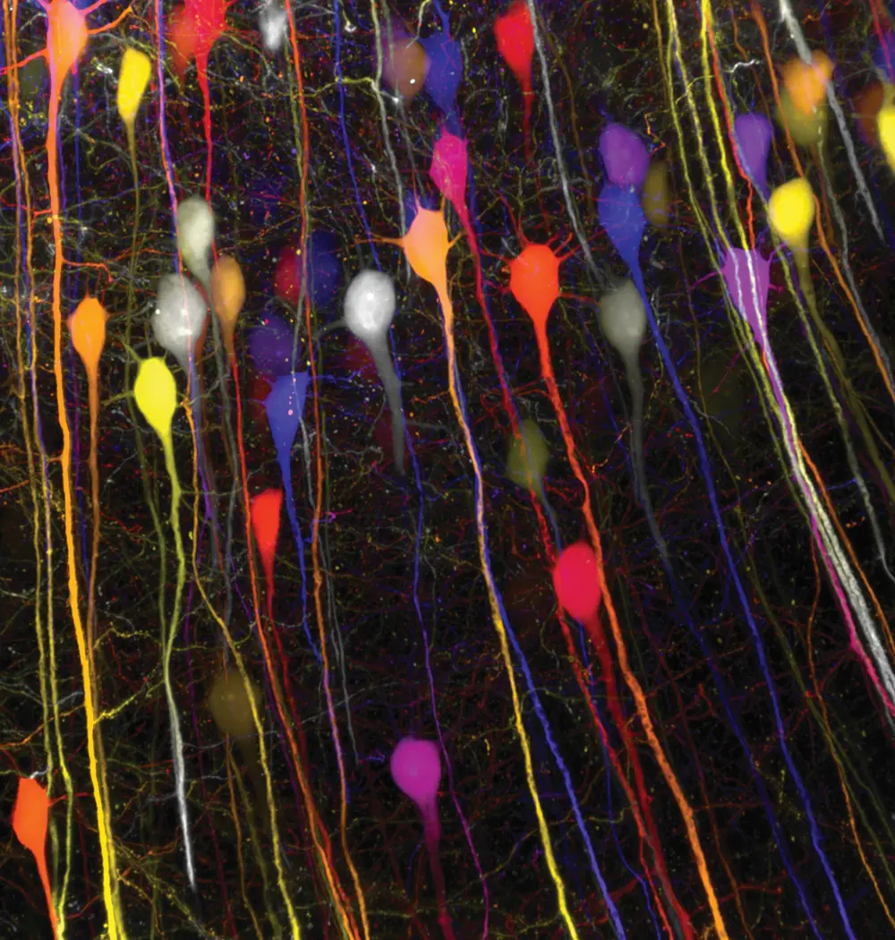 High resolution mouse neurons stained in different colours on a coloured height map.