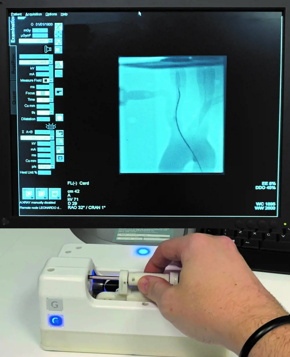 The hand of a medical professional using the control robot in front of a screen with a live generated image of the corresponding treatment room robot's wires inside the patient.