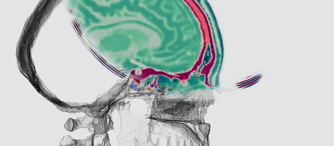 Illustration of a side view of a human head showing a coloured cross‑section of the brain overlaid on a grayscale skull rendering.