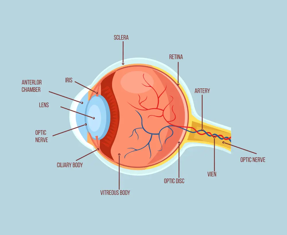 Anatomical drawing of an eye, with the anterior chamber and lens in the front in blue, the vitreous body behind with optic nerves extending into it from behind the eye. The retina is at the back
