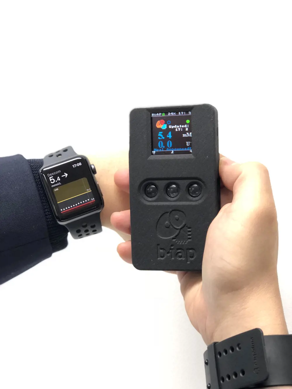 A smartwatch device wrapped around someone's wrist with a screen that is linked to a handheld device that is linked to a blood glucose controller device. 