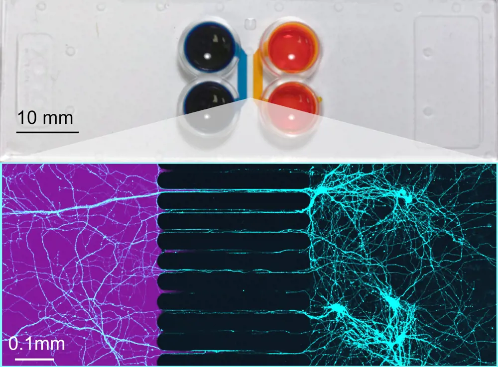 A collage of two images, the top shows two cell culture chambers in a microfluidic chip, delineated in orange and blue dye. The bottom shows a fluorescence microscopy image of cells that are growing teal-coloured, long, thin protrusions into channels separating the compartments,